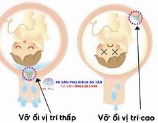 Vỡ Ối Tuần 38